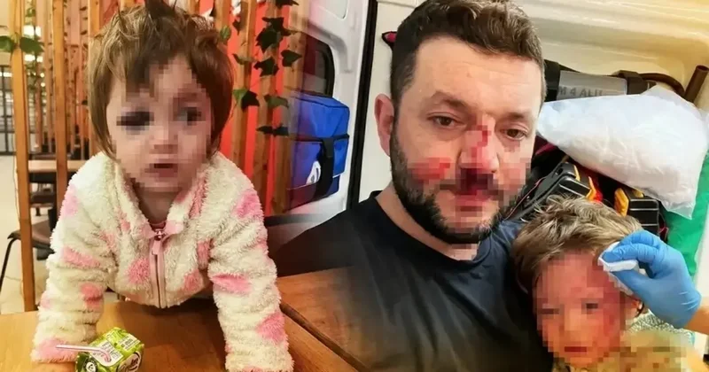 Yalova da baba ve 14 aylık bebeğinin darbedildiği olayla ilgili müfettişler görevlendirildi