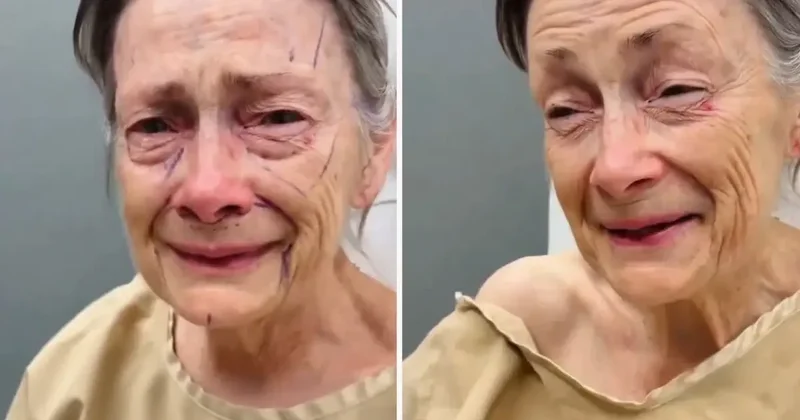 Estetik operasyonu sonrası geçirdiği değişim inanılmaz