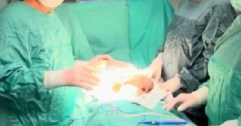 Karın ağrısıyla hastaneye götürdüler! Küçük çocuğun midesinden çıkan şey şoke etti Sözcü Gazetesi