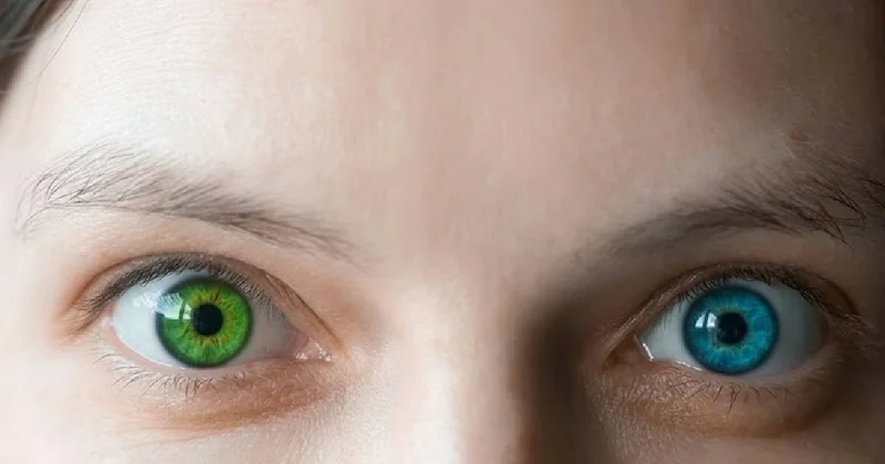 Ne yeşil ne de mavi: En nadir göz rengi belli oldu Sözcü Gazetesi