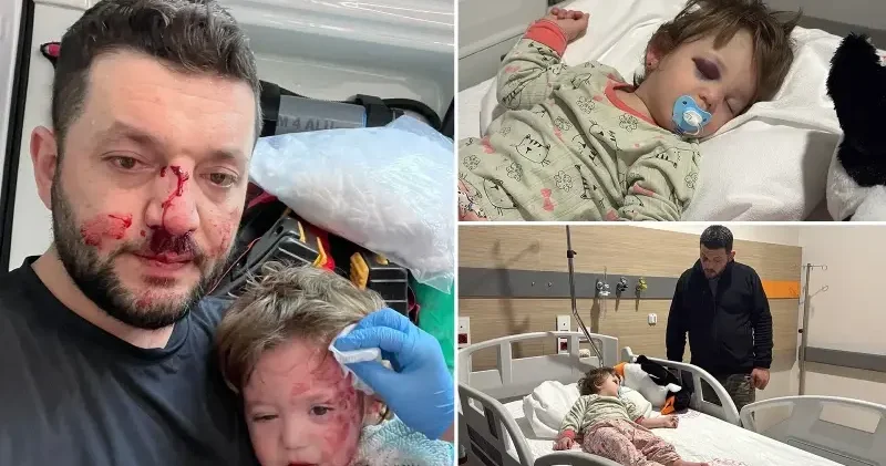 Komşuların gürültü kavgasında 14 aylık bebek darbedilmişti: Komşudan babası kendi burnundaki kanı üzerine akıttı savunması Yalova Haberleri