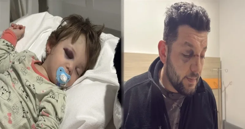 Akın Gürlek ten 14 aylık bebeğe darp olayı açıklaması