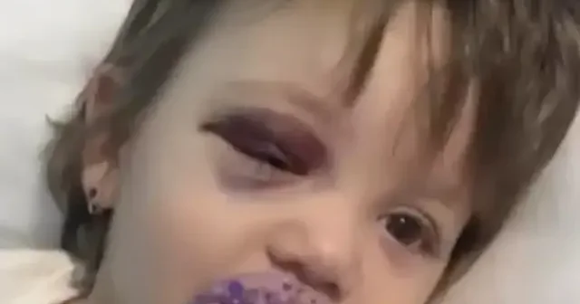 İkra bebek taburcu oldu: Babadan torpido iddiasına sert tepki VİDEO İZLE