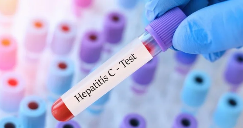 ‘Sağlıkçı’ diye kapı kapı gezip, Hepatit C virüsünü yayıyorlar Sağlık Haberleri