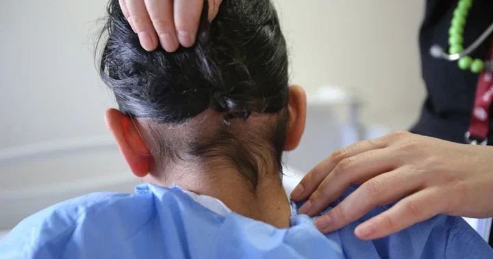 Hatay da 14 yaşındaki çocuğun karnından 3 kilogramlık saç yumağı çıktı