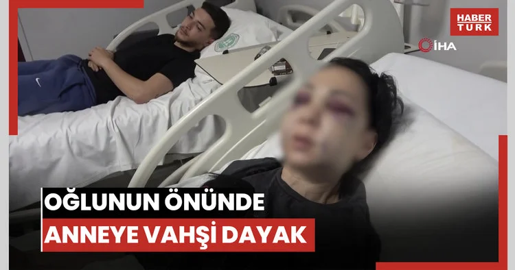 Oğlunun gözü önünde anneyi öldüresiye dövdüler: Yüzü tanınmaz halde