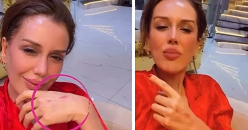 Elleri çizik içinde kaldı! Dilan Polat ın paylaşımları takipçilerini endişelendirdi Sözcü Gazetesi