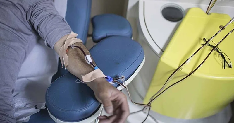 Japon doktor böbrekleri adım adım diyalize götüren 6 besini tek tek sıraladı Sözcü Gazetesi