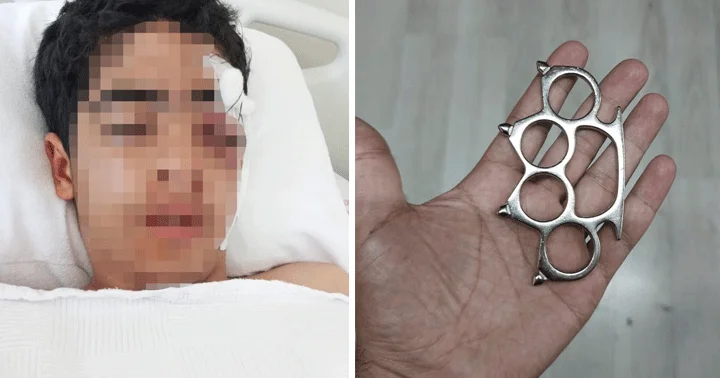 Esenyurt ta dehşet! 15 yaşındaki çocuk Bana şaka yapma dediği arkadaşı tarafından muştayla öldüresiye dövüldü