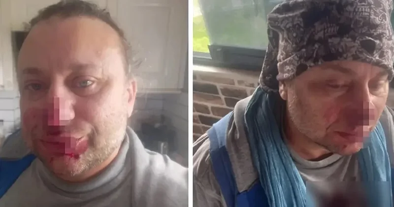 Felaket Tellalı Onur Akay entübe edildi iddiası Sözcü Gazetesi