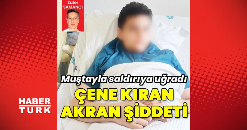 Konya da 12 yaşındaki çocuğun, yaşıtının şiddeti sonucu çene kemiği iki yerden kırıldı