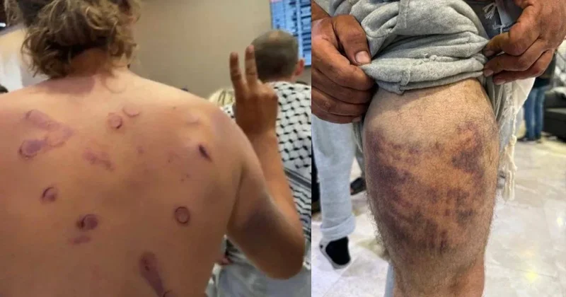 İsrail ordusu hakkında korkunç suçlama: Sumud filosu aktivistlerine tecavüz ettiler Sözcü Gazetesi