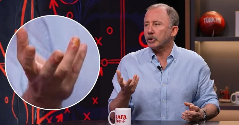 Sergen Yalçın ın parmaklarının görüntüsü merak konusu oldu Sözcü Gazetesi