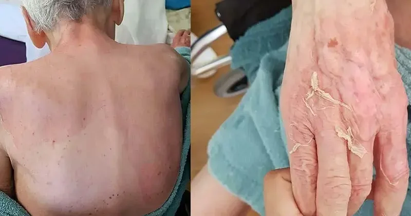 Huzurevinde ölüme verilen taksitli para cezasının gerekçesi: Gerekli tedbirler alınmamış