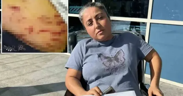 Mersin’de saldırgan köpek çevredekilere saldırdı: Köpeğin ısırdığı anne yaşananları anlattı Gündem Haberleri