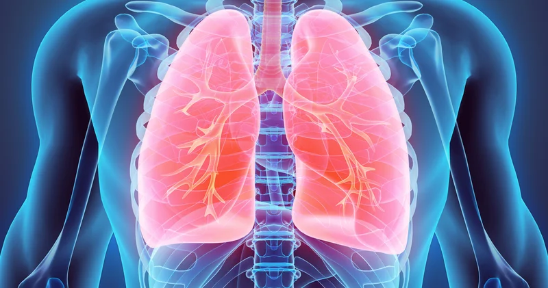Akciğer kanseri tedavisinde sağ kalım oranları artıyor Sağlık Haberleri