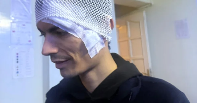 Gaziantep te engelli bakım merkezinde darp skandalı: Merkezde kalan gencin kafasına 6 dikiş atıldı Darp edilen engelli gencin ailesi, sorumluların cezalandırılmasını istedi Engelli gencin vücudundaki darp izleri dikkat çekti Gaziantep Haberleri