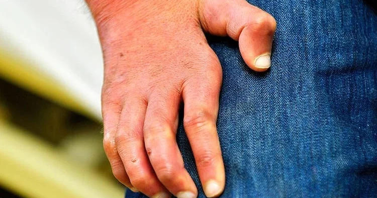 Avrupa alarmda! Tarihin en eski bulaşıcı hastalığı geri döndü