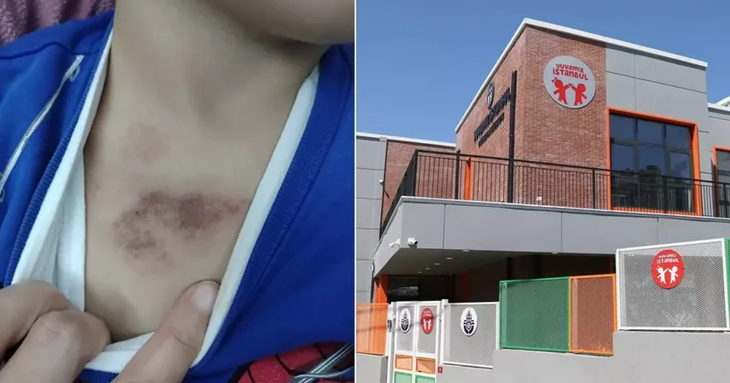 İBB ye bağlı kreşte yaşananlar ilişkin ifade veren mağdur çocuk: Bir arkadaşımı sadece dövdü, elbisemi indirip çıplakken kameraya çekti