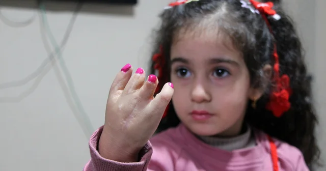 10 ameliyat geçiren yapışık parmak Elif Lina nın ailesinden çağrı Adana Haberleri