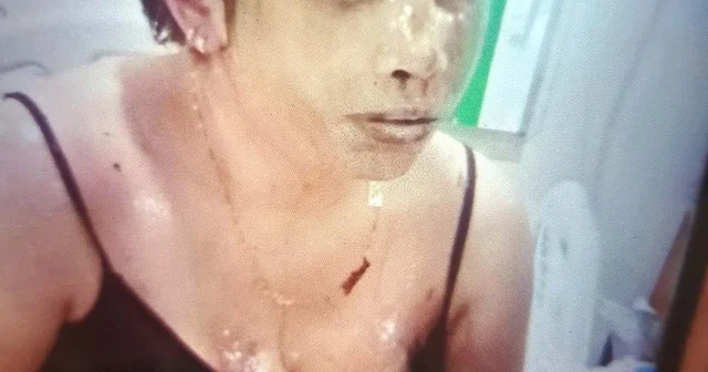 Boşanma aşamasındaki eşini koli bandı ile bağlayıp, başından aşağı kezzap döktü Gaziantep Haberleri