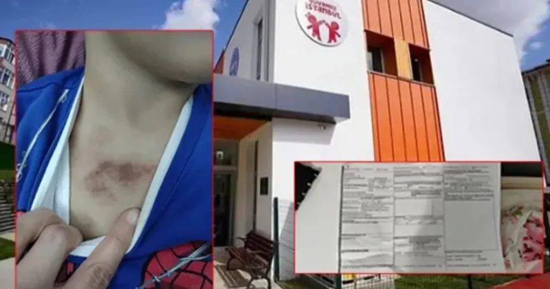 SON DAKİKA... İBB’ye bağlı kreşte darp ve cinsel istismar skandalı! Mağdur çocuk tek tek anlattı: Çıplakken kameraya çekti!