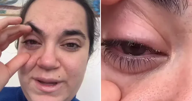 Bulaşık makinesi tableti, kadının gözüne patladı, kör olma korkusu yaşadı