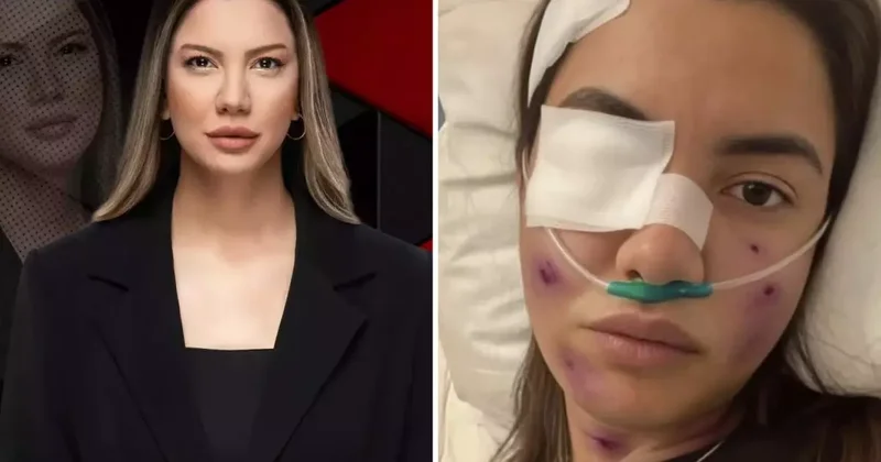 Fulya Öztürk trafik kazası mı geçirdi? Elden ele dolaşan görselle ilgili açıklama var