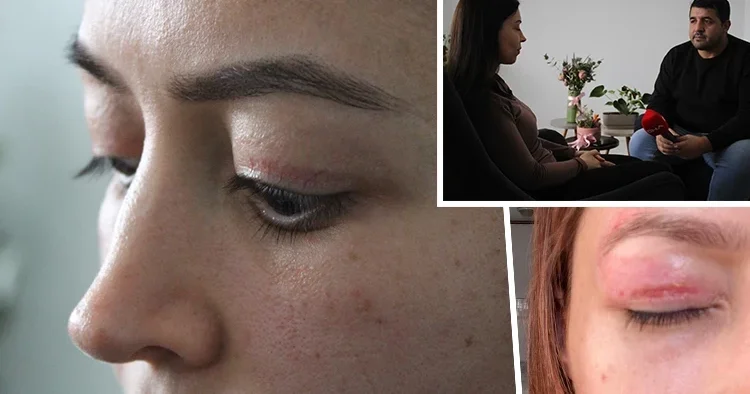 Güzellik salonundaki 1.100 TL lik işlem genç kadının kabusu oldu: Şikayeti reddedildi Çevremdekiler fark etti