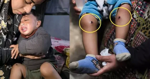 İsrail askerlerinden babayı itirafa zorlamak için 1,5 yaşındaki bebeğe işkence