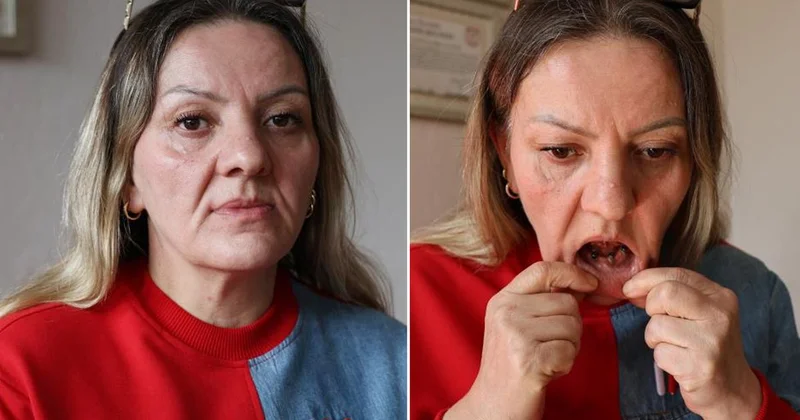 Diş ağrısı şikayetiyle gitti, 25 dişinden oldu