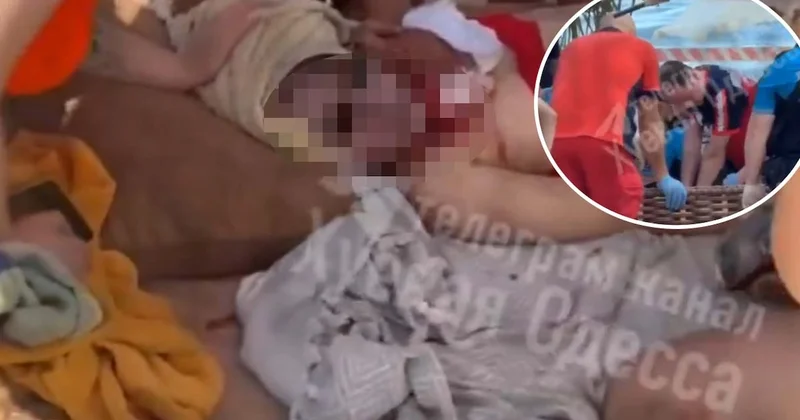 Odessa’da plajda güneşlenen kadın Rusya’nın dron saldırında öldü Sözcü Gazetesi