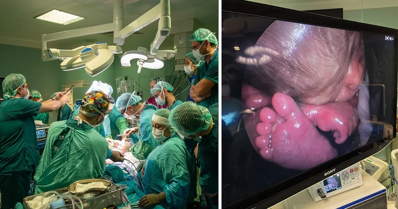 Ankara da anne karnındaki bebeğe dünyanın parmak ısırdığı operasyon! Saatlerce süren ameliyatla gelen mucize Sözcü Gazetesi