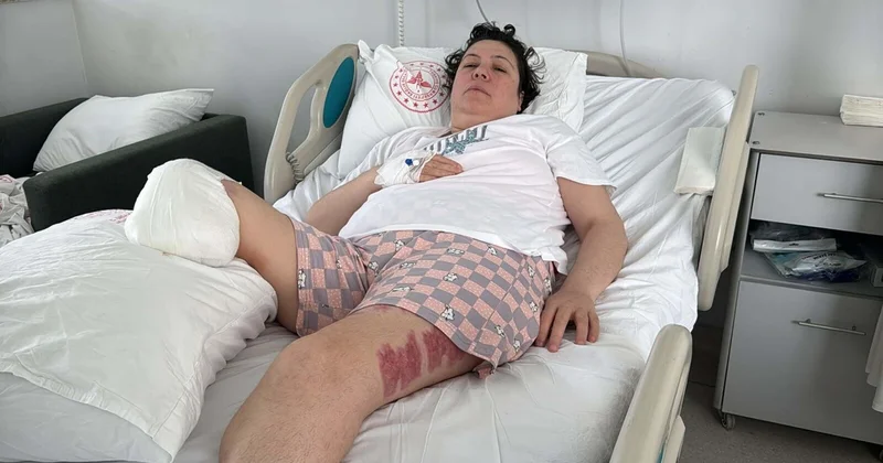 Eşini vurup iki bacağının kesilmesine neden olmuştu: Sanıktan mahkemede özür