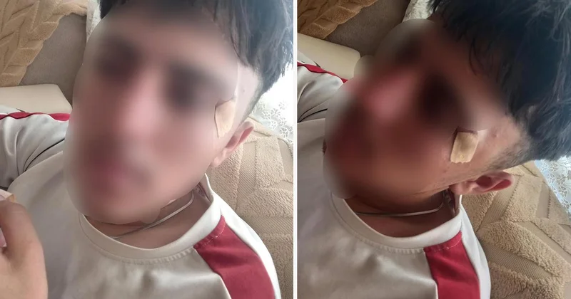İddia vahim! Öğretmenin kafa attığı çocuğun burnu kırıldı