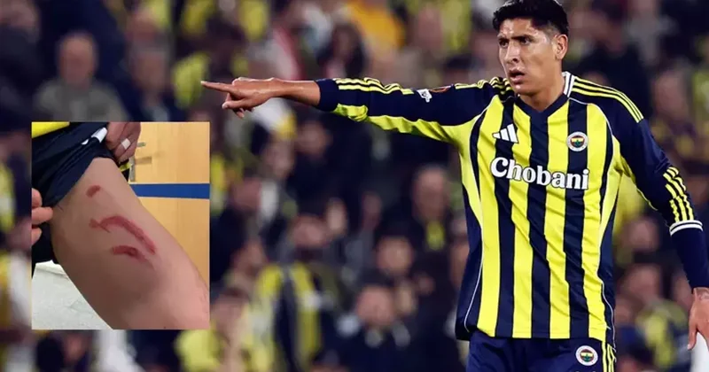 Edson Alvarez in sakatlığında son durum! Stuttgart maçının ardından bacağının durumunu paylaşmıştı Fanatik Gazetesi Fenerbahçe (FB) Haberleri Spor