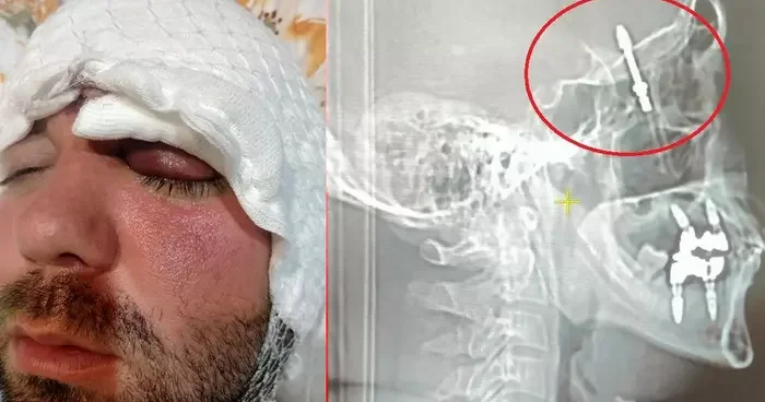Bursa da inanılmaz olay: Dişçiye gitti, hayatı kabusa döndü! Neredeyse ölüyordu