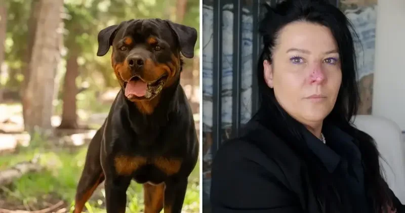 Arkadaşının köpeği tarafından burnu parçalanan kadın 8 ay pipetle beslendi: Acısı korkunç bir acı ölmediğim için şükrediyorum Aktüel Haberleri