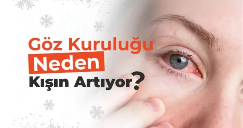 Op. Dr. Özer Kavalcıoğlu Göz Kuruluğu İle İlgili Merak Edilenleri Açıklıyor.