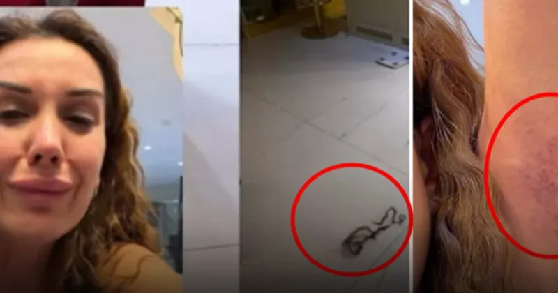 Dilan Polat en yakınından tekme tokat dayak yedi Sözcü Gazetesi