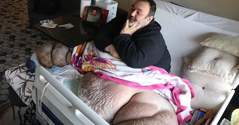 DHA nın haberi sonrası fil hastası babaya yardım eli