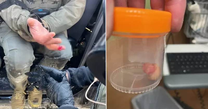 ICE karşıtı protestolarda şoke eden olay: Görevlinin parmağını ısırarak kopardılar