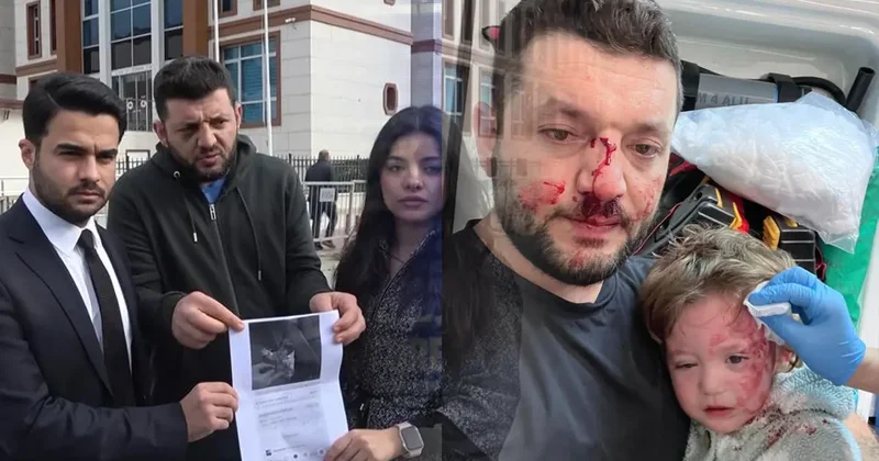 Yalova da 14 aylık bebeğin yaralandığı saldırıda pes dedirten ifade: Amacım babasına vurmaktı, fırlattığım cisim...