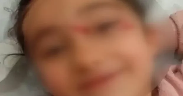 İstanbul haberleri Yer: Eyüpsultan! Okul dönüşü başıboş köpek dehşeti: 6 yaşındaki çocuk hastanelik oldu 25 Mart 2026