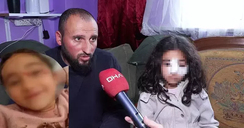 Eyupsultan da okuldan eve dönen 6 yaşındaki çocuğa sokak köpekleri saldırdı