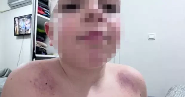 Antalya haberleri Antalya da İlkokulda darp iddiası! Aile öğretmenden şikayetçi oldu 25 Mart 2026