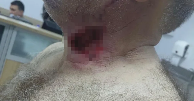 At sahibini boğazından ısırarak ağır yaraladı Diyarbakır Haberleri