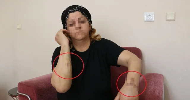 16 yıl dini nikahla birlikte yaşadığı kişi tarafından 30 yerinden bıçaklandı Diyarbakır Haberleri