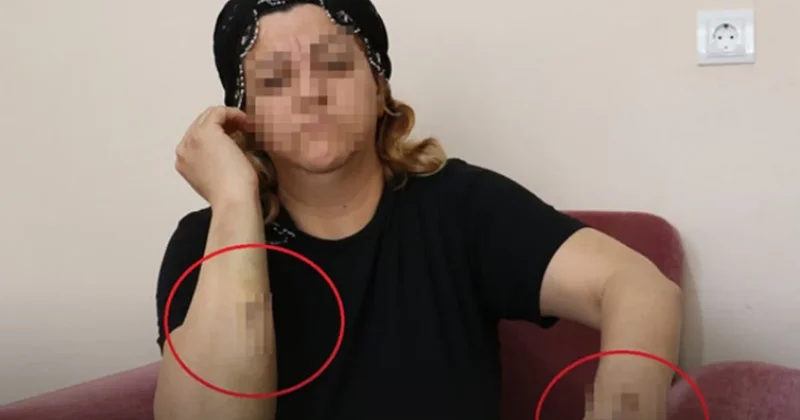 Diyarbakır’da kanlı pusu! Talihsiz kadını 30 yerinden bıçakladı Sözcü Gazetesi