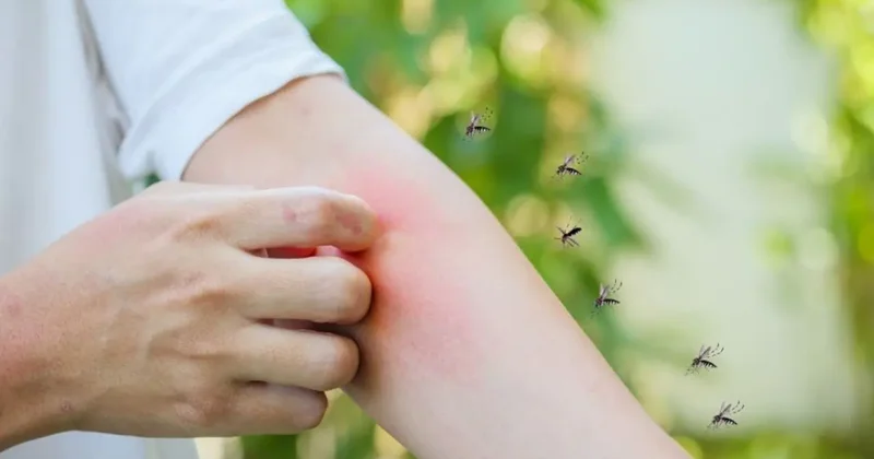 Asya Kaplan Sivrisineği vakaları endişeye yol açtı: Alerjik bünyeye sahipseniz dikkat!